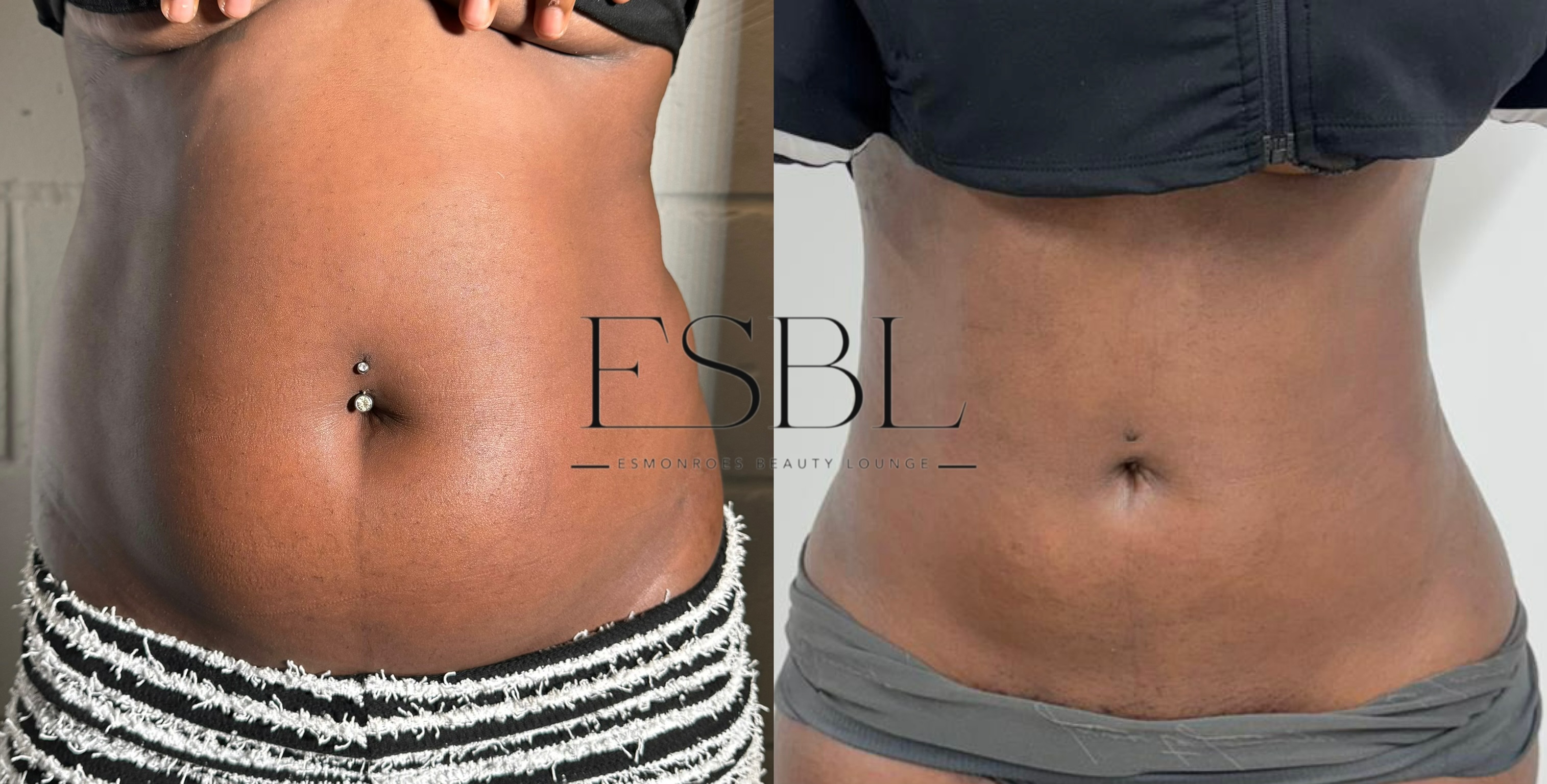 Cosmetic Surgery Consultation